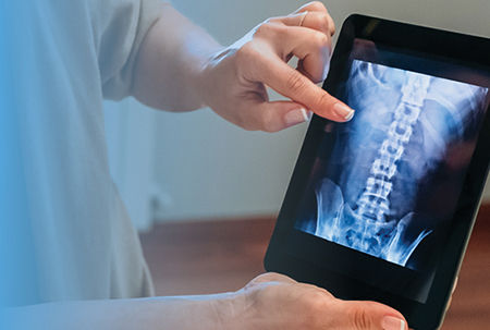 MPH Consultants Mobile Spine