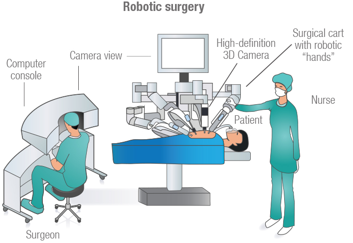 Robotic-Surgery-Illustration