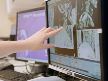 A hand is pointing to a computer screen showing x-ray scans of a person's head and neck area.