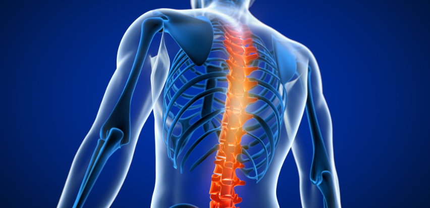 Compression Spinal Fractures: Symptoms, Causes & Treatments