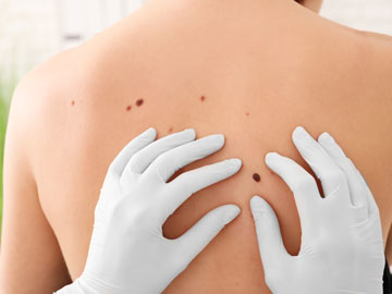 dermatology_mobile